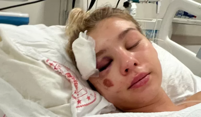 Maja miała wypadek w Turcji. Doznała rozległych obrażeń