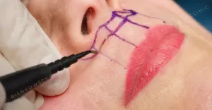 lip lift bienkowscy clinic bydgoszcz czestochowa